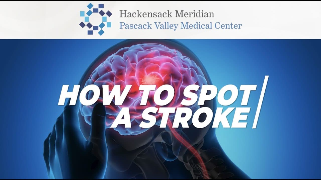 How to spot a stroke text